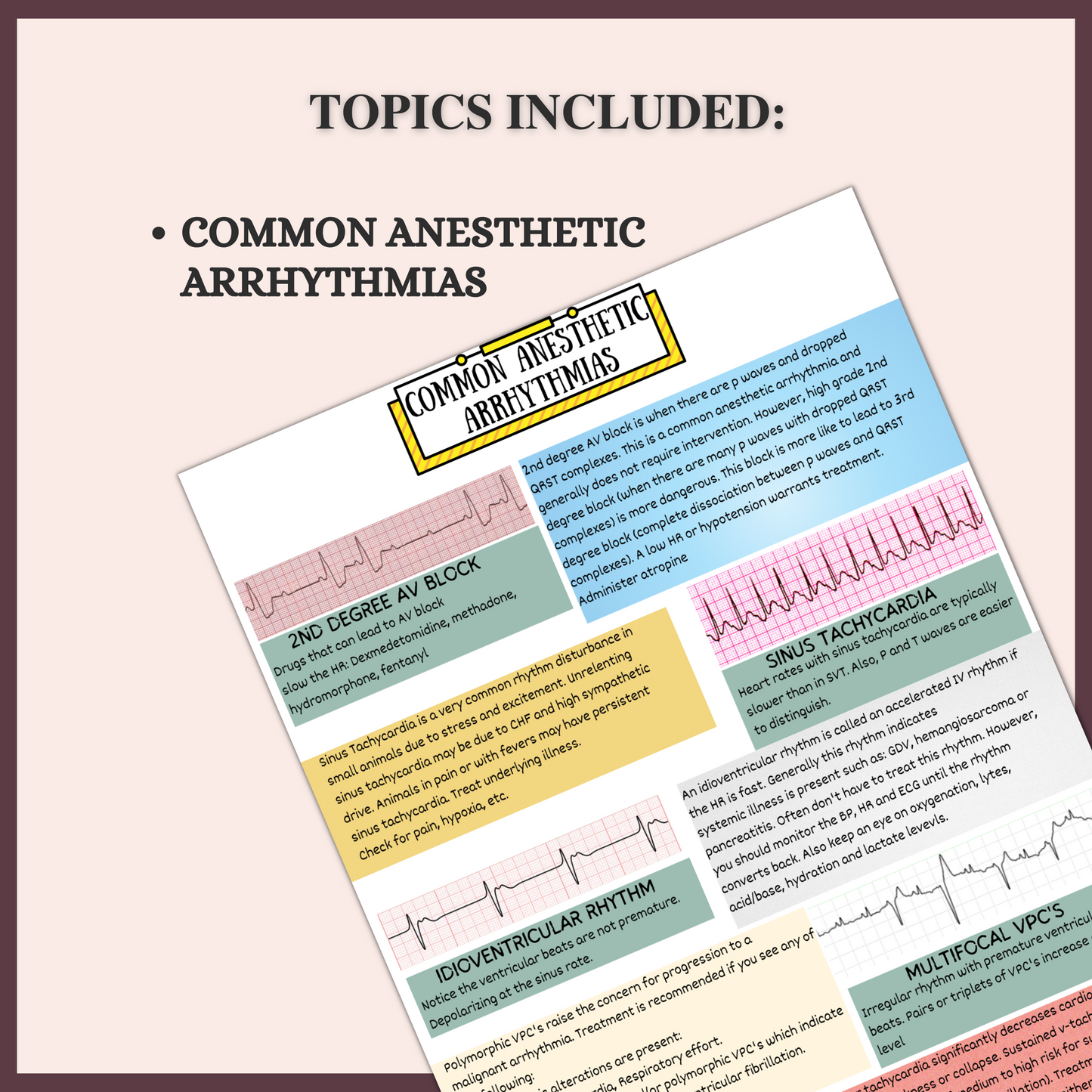 COMMON ANESTHETIC ARRHYTHMIAS | 1 PAGE| 3 TOPICS